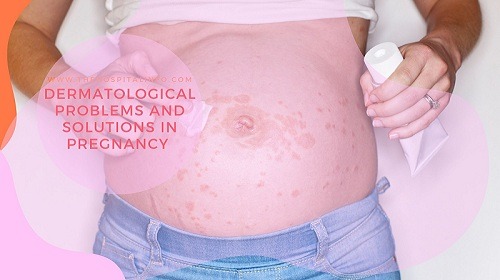 This image has an empty alt attribute; its file name is Dermatological-problems-and-solutions-in-pregnancy.jpg
